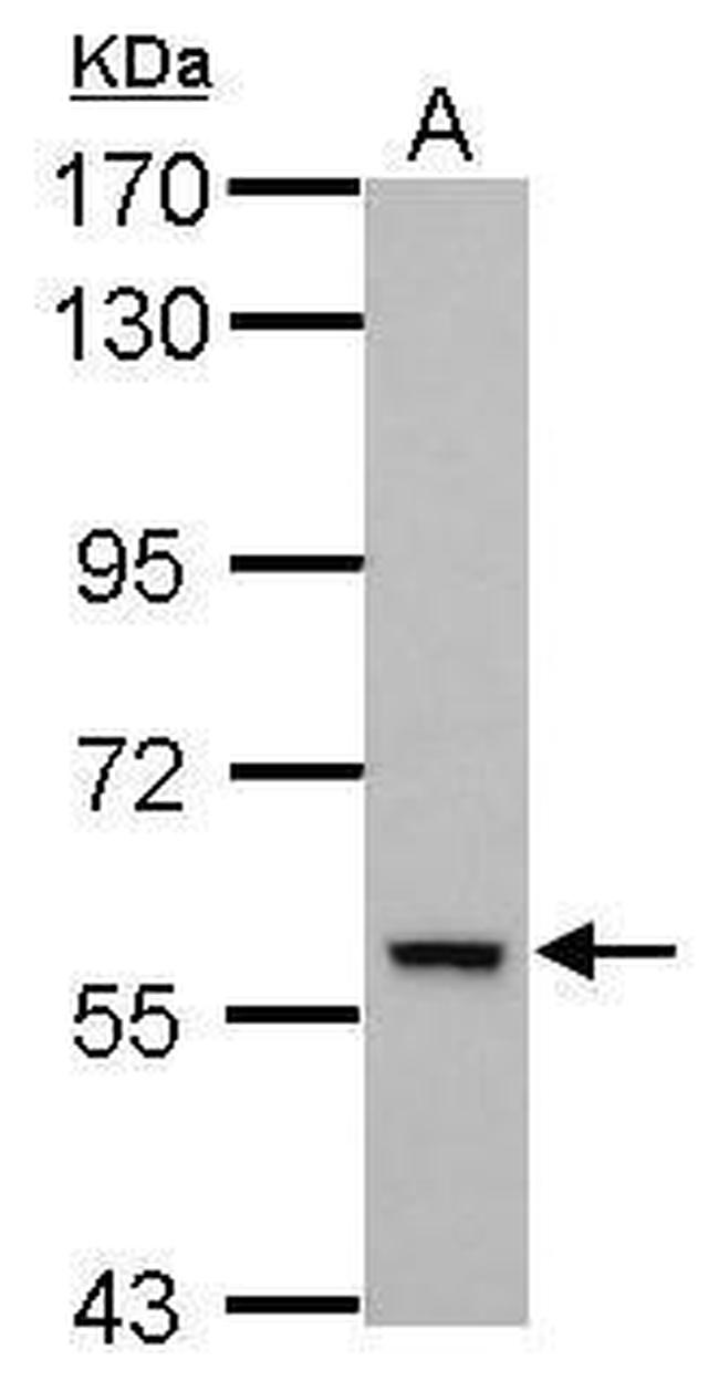 DEAF1 Antibody in Western Blot (WB)