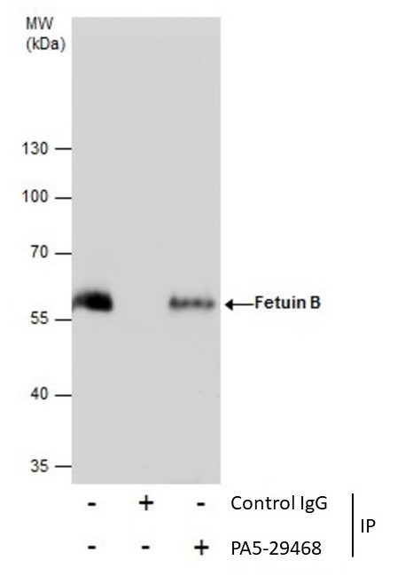 Fetuin B Antibody in Immunoprecipitation (IP)