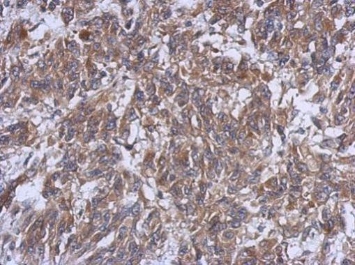 HERPUD1 Antibody in Immunohistochemistry (Paraffin) (IHC (P))