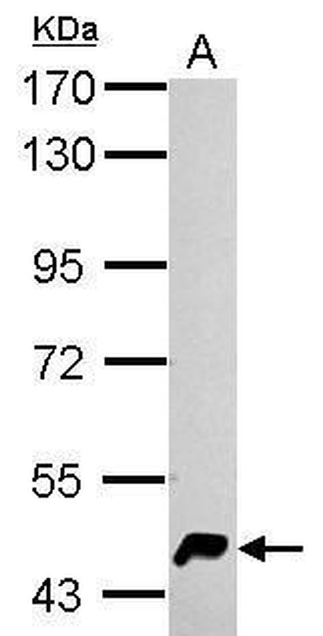 HERPUD1 Antibody in Western Blot (WB)