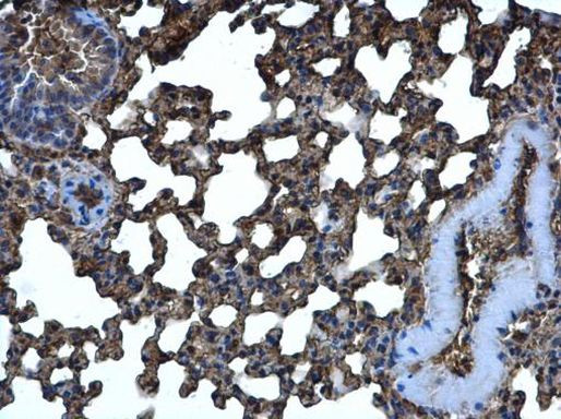 CRMP5 Antibody in Immunohistochemistry (Paraffin) (IHC (P))