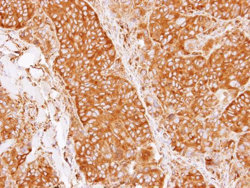 CRMP5 Antibody in Immunohistochemistry (Paraffin) (IHC (P))