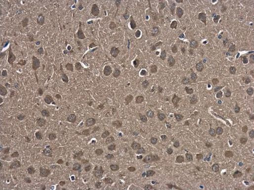 HSPA4 Antibody in Immunohistochemistry (Paraffin) (IHC (P))