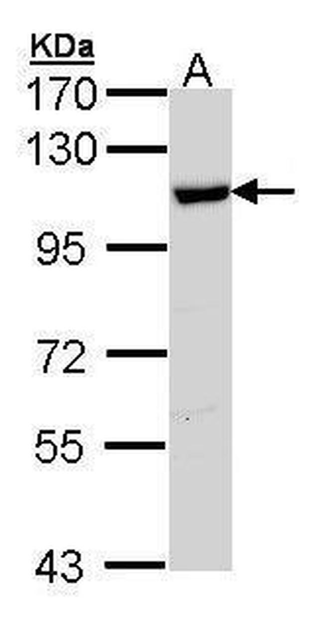 HSPA4 Antibody in Western Blot (WB)