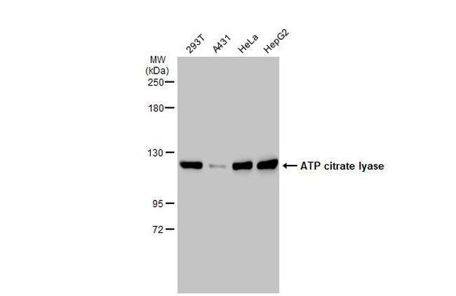 ATP Citrate Lyase Polyclonal Antibody (PA5-29497)