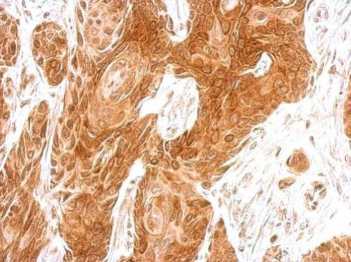 AMFR Antibody in Immunohistochemistry (Paraffin) (IHC (P))