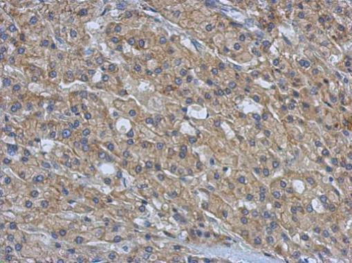 AMFR Antibody in Immunohistochemistry (Paraffin) (IHC (P))