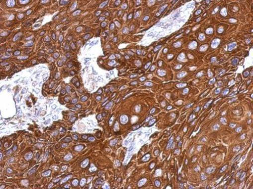 Cytokeratin 33B Antibody in Immunohistochemistry (Paraffin) (IHC (P))