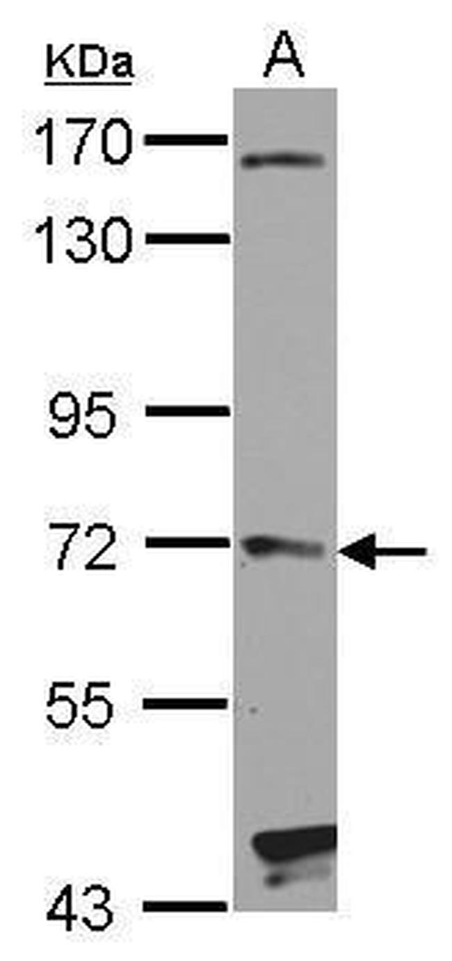 HHIP Antibody in Western Blot (WB)