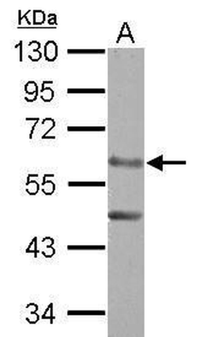 ERO1L Antibody in Western Blot (WB)