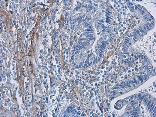 COL1A1 Antibody in Immunohistochemistry (Paraffin) (IHC (P))