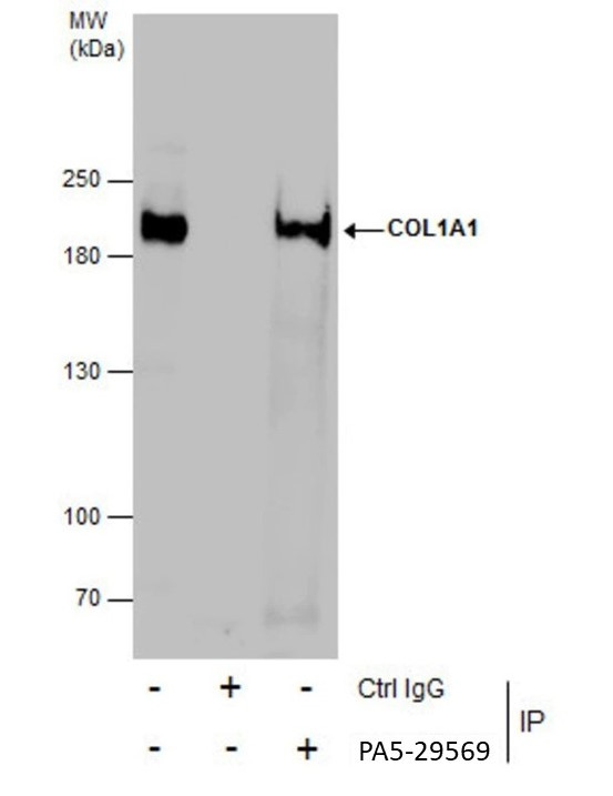 COL1A1 Antibody in Immunoprecipitation (IP)