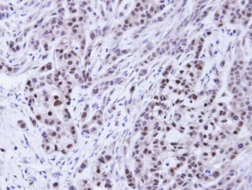 BAG1 Antibody in Immunohistochemistry (Paraffin) (IHC (P))