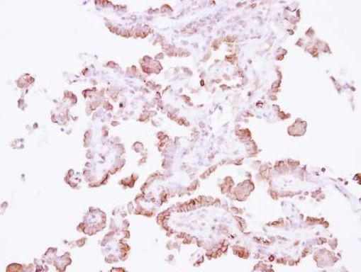 CD44 Antibody in Immunohistochemistry (Paraffin) (IHC (P))