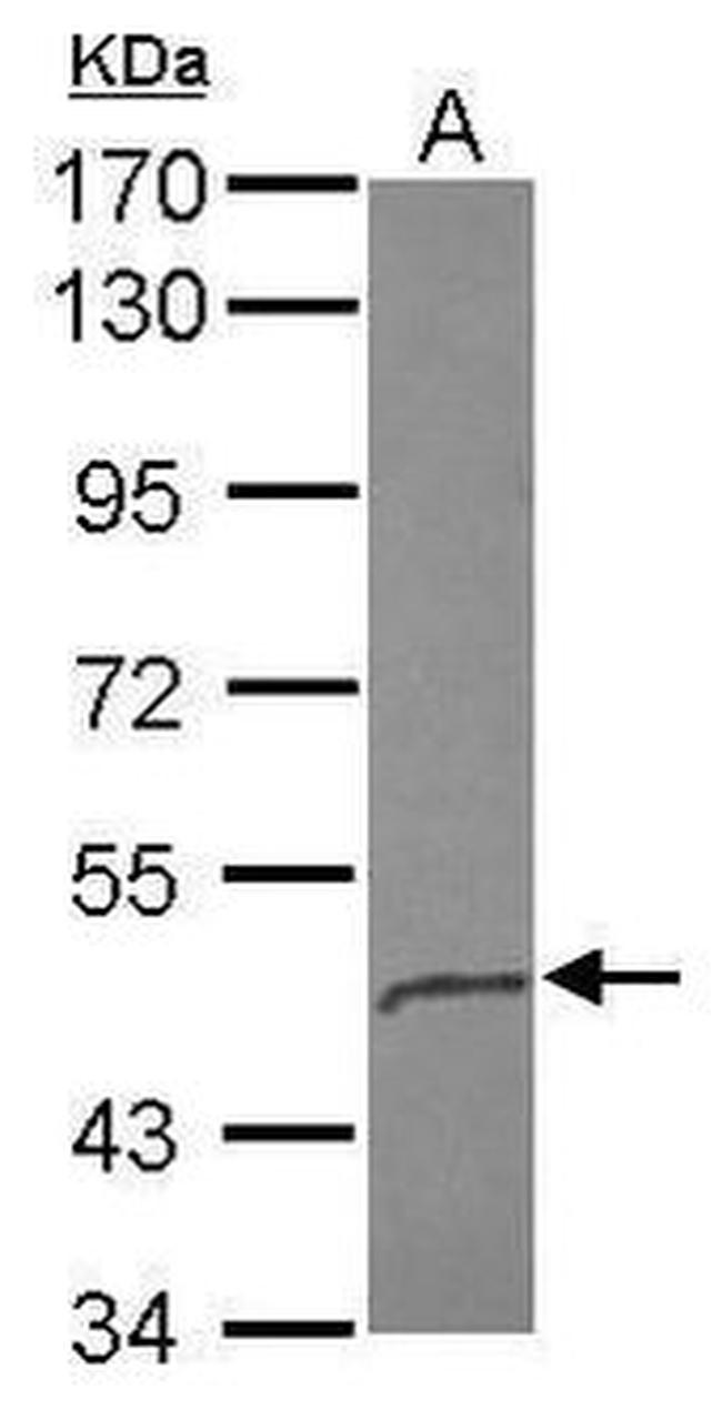 CD44 Antibody in Western Blot (WB)