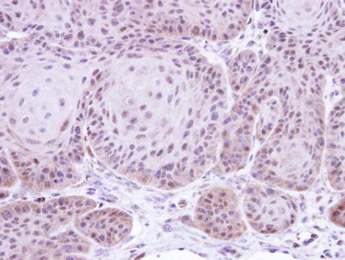 DAXX Antibody in Immunohistochemistry (Paraffin) (IHC (P))