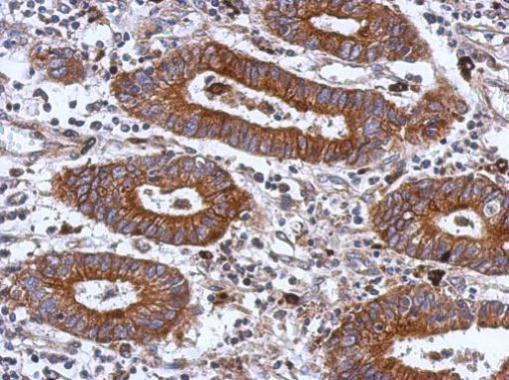 ITGB1 Antibody in Immunohistochemistry (Paraffin) (IHC (P))