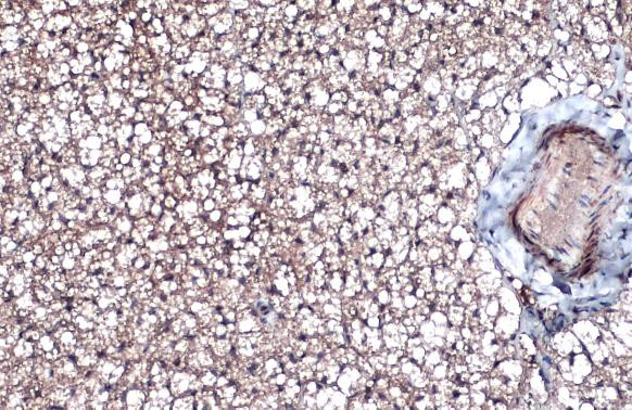 ITGB1 Antibody in Immunohistochemistry (Paraffin) (IHC (P))