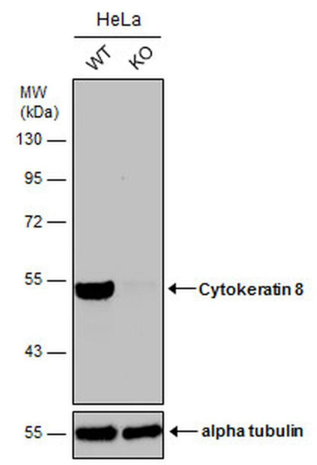 Cytokeratin 8 Antibody
