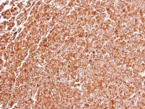 TLR3 Antibody in Immunohistochemistry (Paraffin) (IHC (P))