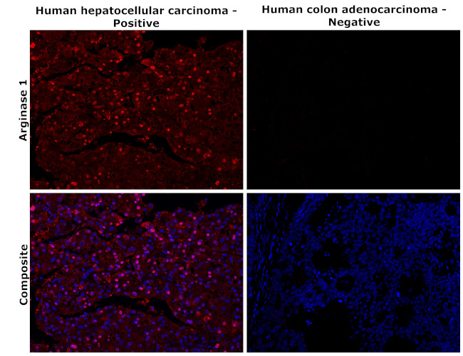 Arginase 1 Antibody in Immunohistochemistry (Paraffin) (IHC (P))