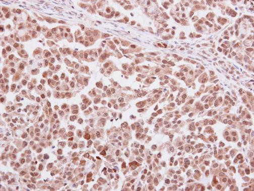 SERPINC1 Antibody in Immunohistochemistry (Paraffin) (IHC (P))