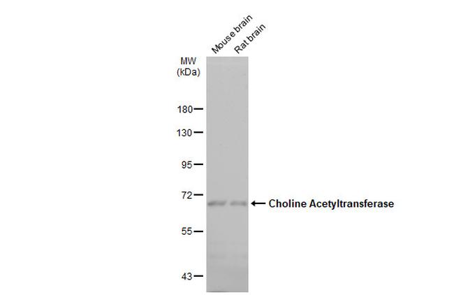 ChAT Antibody in Western Blot (WB)