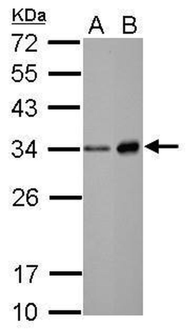 Neutrophil elastase Antibody in Western Blot (WB)