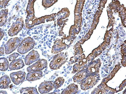 Cytokeratin 5 Antibody in Immunohistochemistry (Paraffin) (IHC (P))