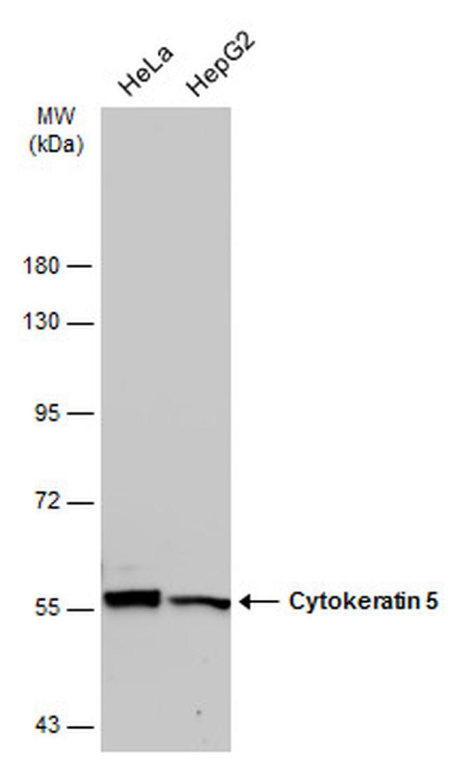 Cytokeratin 5 Antibody in Western Blot (WB)