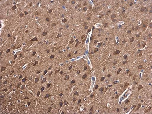 PKC beta Antibody in Immunohistochemistry (Paraffin) (IHC (P))