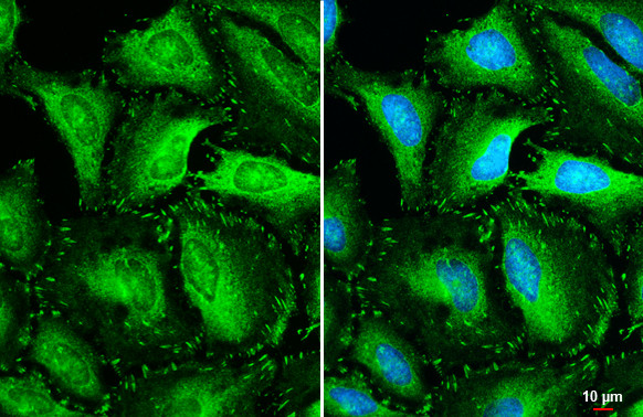 Vinculin Antibody in Immunocytochemistry (ICC/IF)