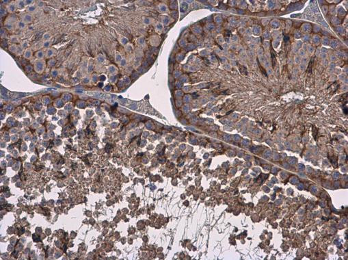 Vinculin Antibody in Immunohistochemistry (Paraffin) (IHC (P))