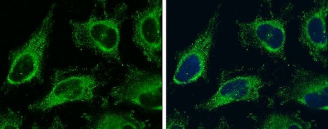 Vinculin Antibody in Immunocytochemistry (ICC/IF)