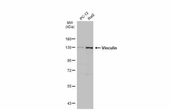 Vinculin Antibody in Western Blot (WB)