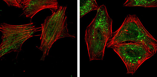 ATG5 Antibody in Immunocytochemistry (ICC/IF)