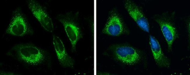 GRP78 Antibody in Immunocytochemistry (ICC/IF)