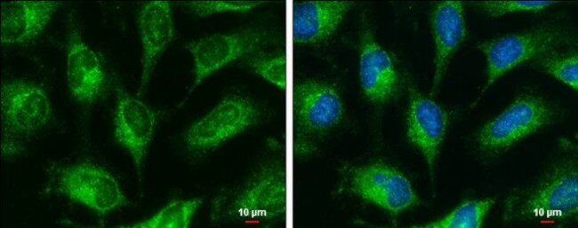 GRP78 Antibody in Immunocytochemistry (ICC/IF)