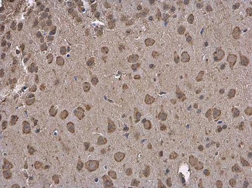 GRP78 Antibody in Immunohistochemistry (Paraffin) (IHC (P))