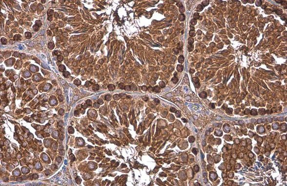 GRP78 Antibody in Immunohistochemistry (Paraffin) (IHC (P))