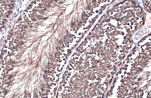 GRP78 Antibody in Immunohistochemistry (Paraffin) (IHC (P))