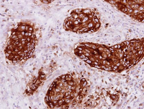 CEACAM1 Antibody in Immunohistochemistry (Paraffin) (IHC (P))