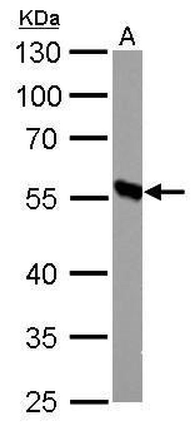 DBT Antibody in Western Blot (WB)