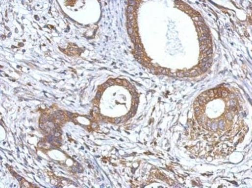 NF2 Antibody in Immunohistochemistry (Paraffin) (IHC (P))