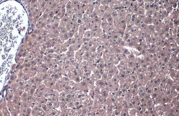 PP2A alpha Antibody in Immunohistochemistry (Paraffin) (IHC (P))