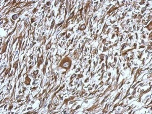 ST14 Antibody in Immunohistochemistry (Paraffin) (IHC (P))