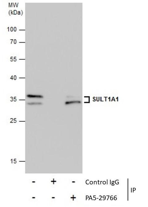 SULT1A1 Antibody in Immunoprecipitation (IP)