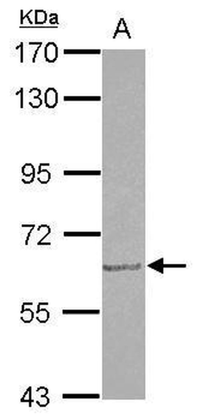 GDF5 Antibody in Western Blot (WB)