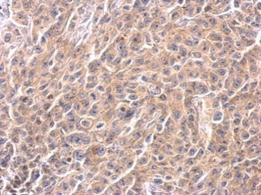 Caspase 4 Antibody in Immunohistochemistry (Paraffin) (IHC (P))