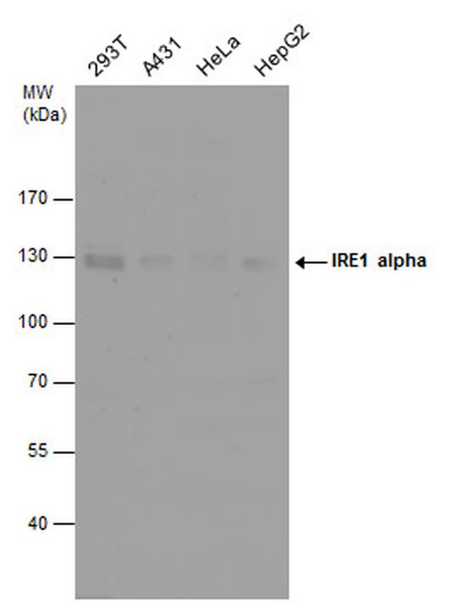 IRE1 alpha Antibody in Western Blot (WB)